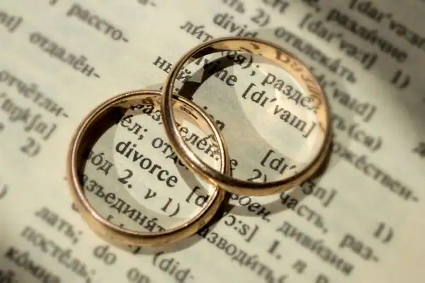 Image of rings removed before divorce mediation Chelmsford